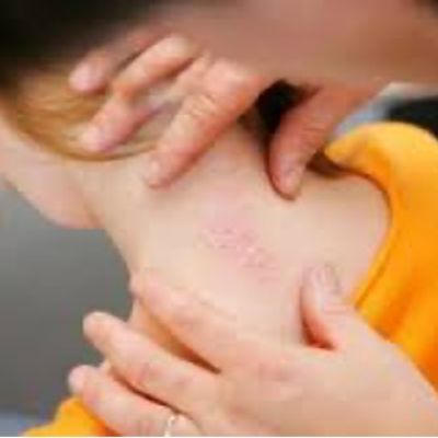 29 октября- Всемирный день борьбы с псориазом